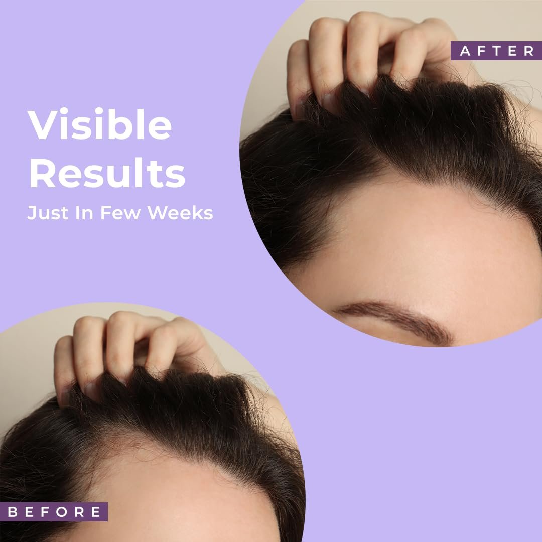 WOW Skin Science Rosemary + Biotin Pro Hair Growth Water Spray thumbnail