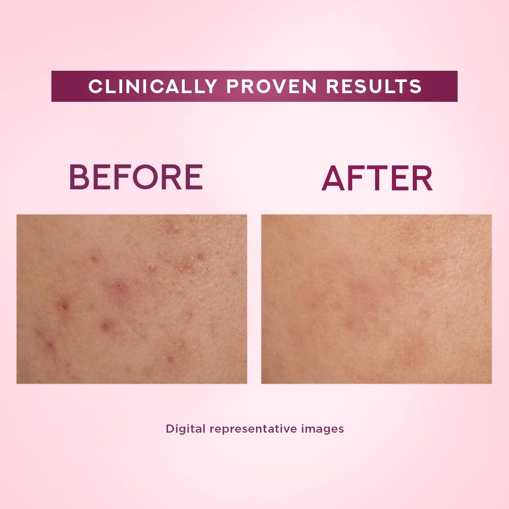 Pond's Bright Beauty Light Cream with UV Filter | Niasorcinol | 100x Better than Vitamin C | Niacinamide | Fades Dark Spots, Brightens Skin, 50g thumbnail