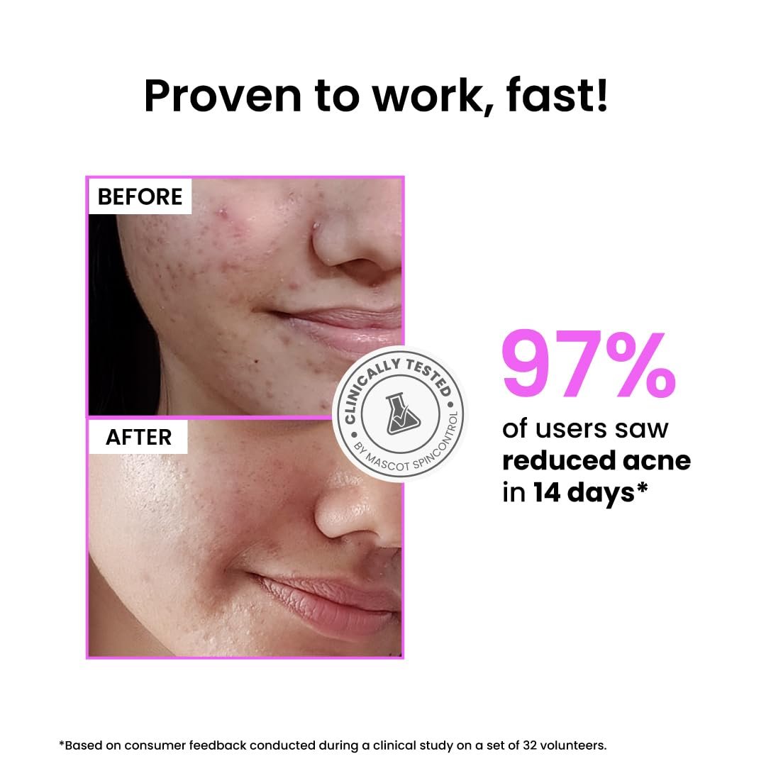 Foxtale 12% Niacinamide Face Serum with Azelaic Acid for Oil Control, Fade Marks, Acne & Dark Spots | Brightens & Clear Complexion, for Oily, Blemish-Prone, & Combination Skin | 30 ml thumbnail