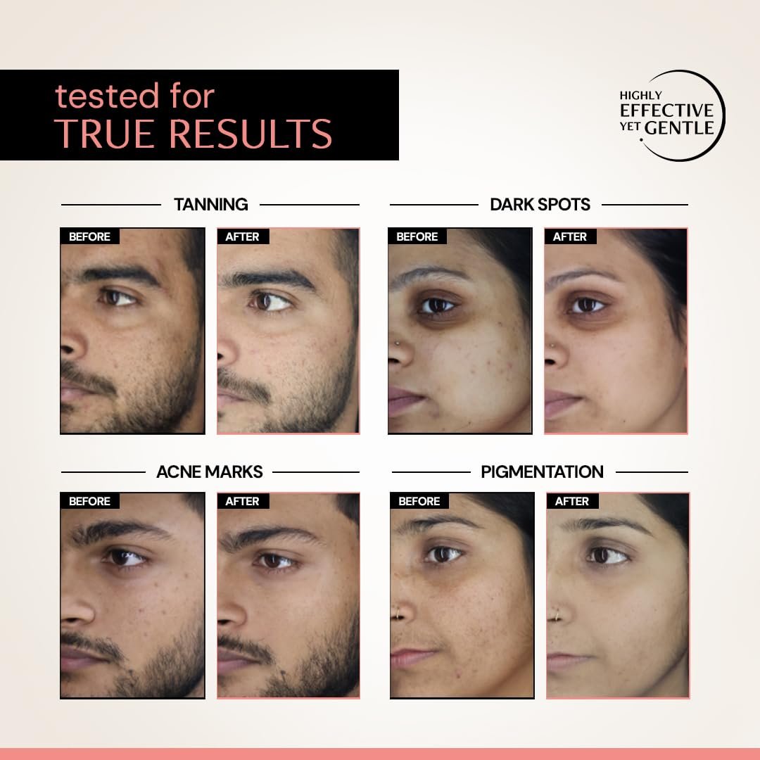 Deconstruct 5% Niacinamide Serum + 2% Alpha Arbutin Clearing Serum| Clinically Tested| Reduces Dark Spots, Pigmentation, Acne Marks & Tanning |4-in-1 Multi-Benefit |Non-Irritating | 20ml thumbnail