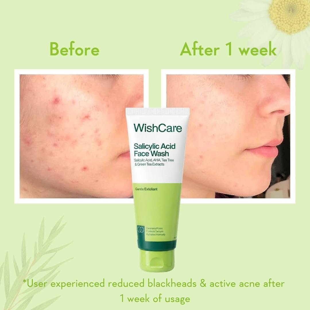 WishCare Salicylic Acid Face Wash For Women & Men | Reduces Acne & Controls Oil | With AHA, Green Tea, Chamomile & Tea Tree | Salicylic Acid Face Wash For Oily Skin & Acne Prone Skin | 100ml thumbnail