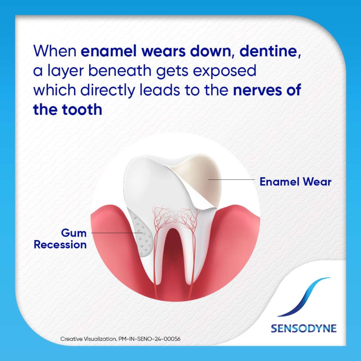 Sensodyne Toothpaste Fresh Gel | Daily Sensitivity Relief Tooth Paste Pack of 1 - 75gm | thumbnail