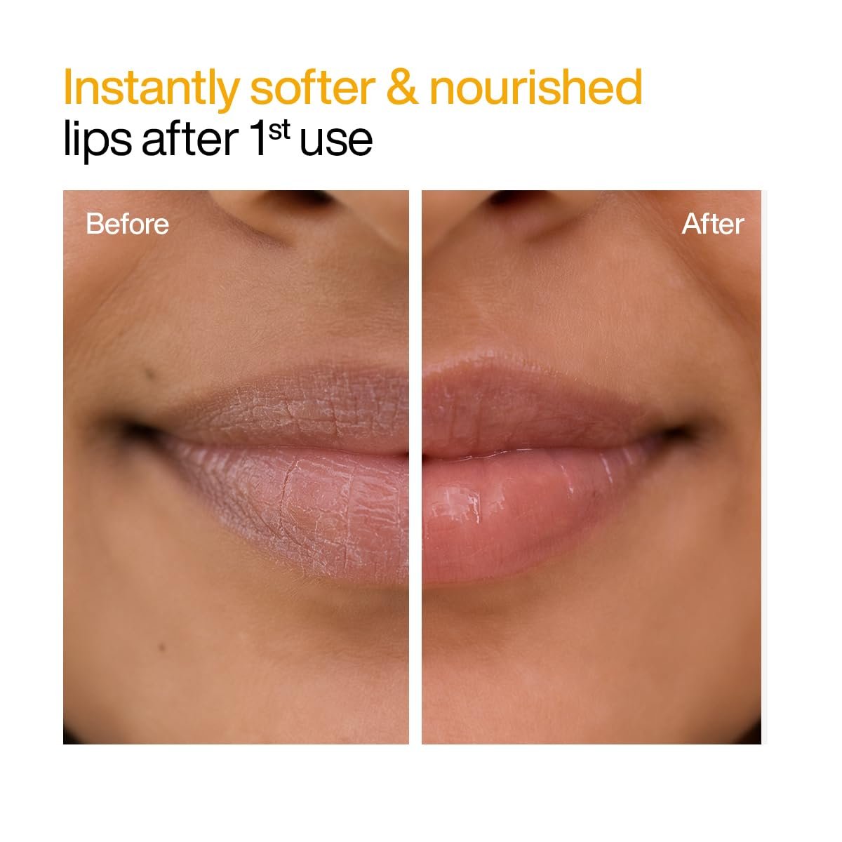 WishCare Ceramide Lip Balm SPF 50 PA++++ | Brightening Lip Balm for Dark Lips | In-Vivo Tested | Kojic Acid & Niacinamide | Natural & Untinted | For Women & Men | 5g thumbnail