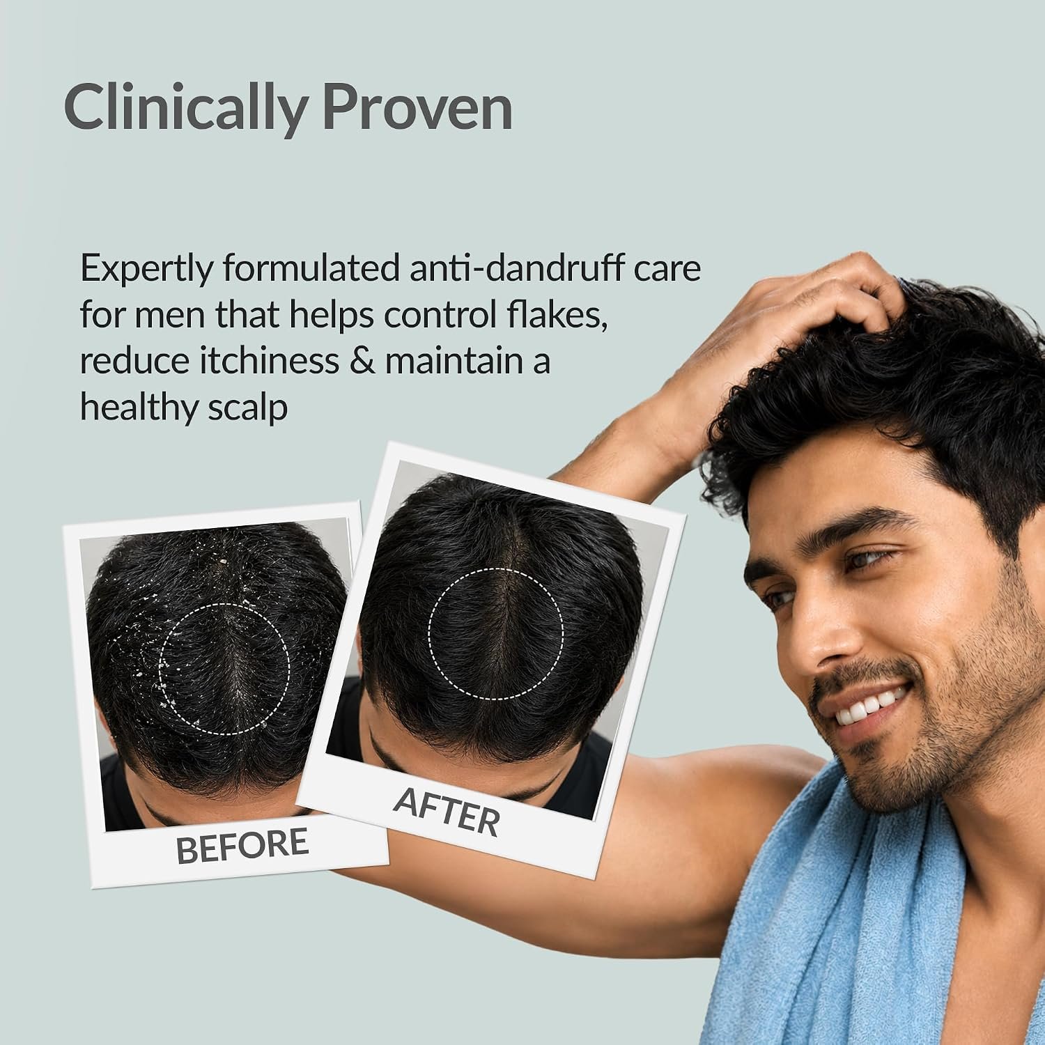 Fixderma Anti-Dandruff Shampoo with Salicylic Acid for Men | Scalp Cleansing Shampoo for Dandruff, Itchy & Flaky Scalp | 100ml thumbnail