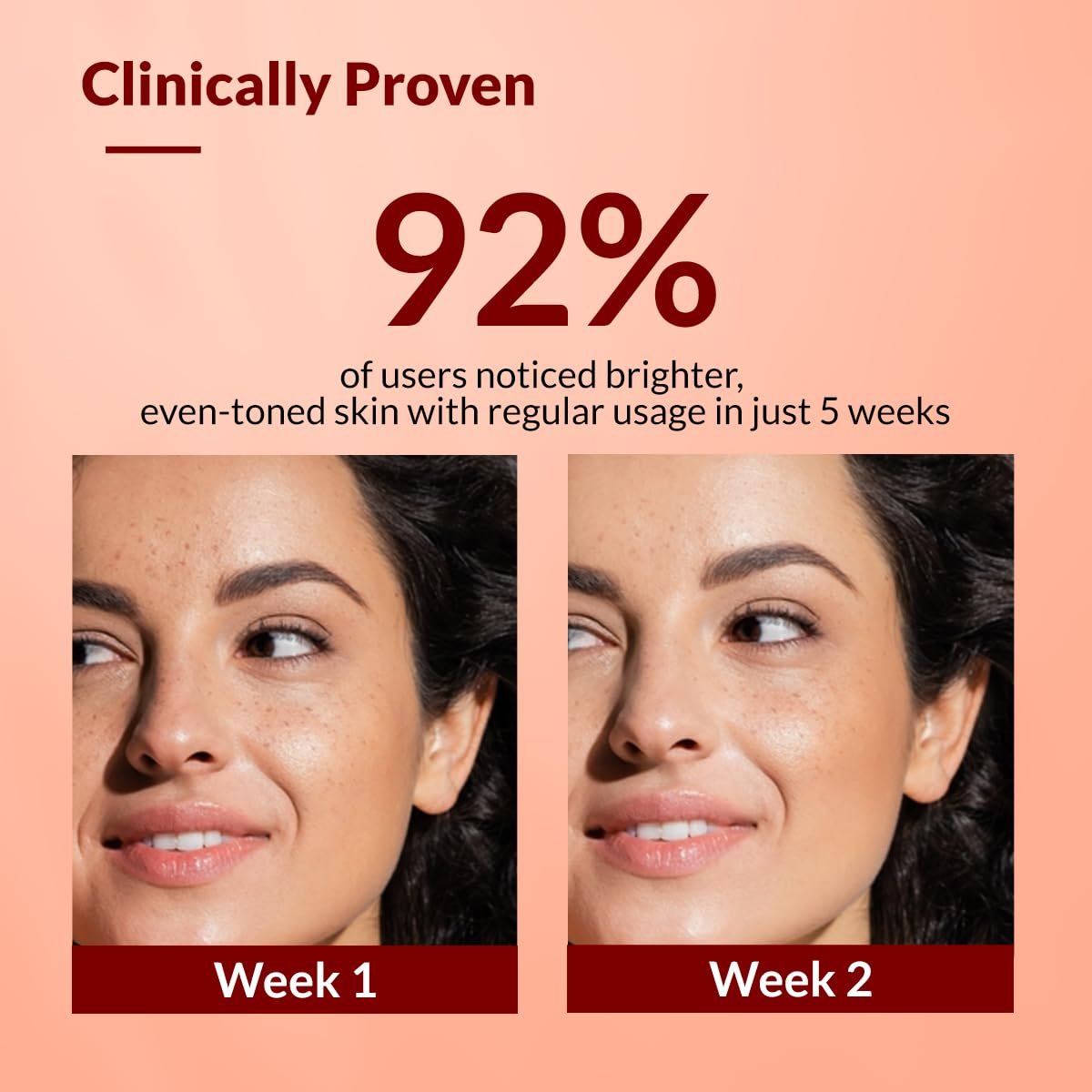 Fixderma Tranexamic Acid + 2% Kojic Acid + 1% Arbutin SKARFIX -TX Face Cream | Pigmentation Removal Cream | Kojic Acid | Uneven Skin Tone - 15 gm (Pack of 1) thumbnail