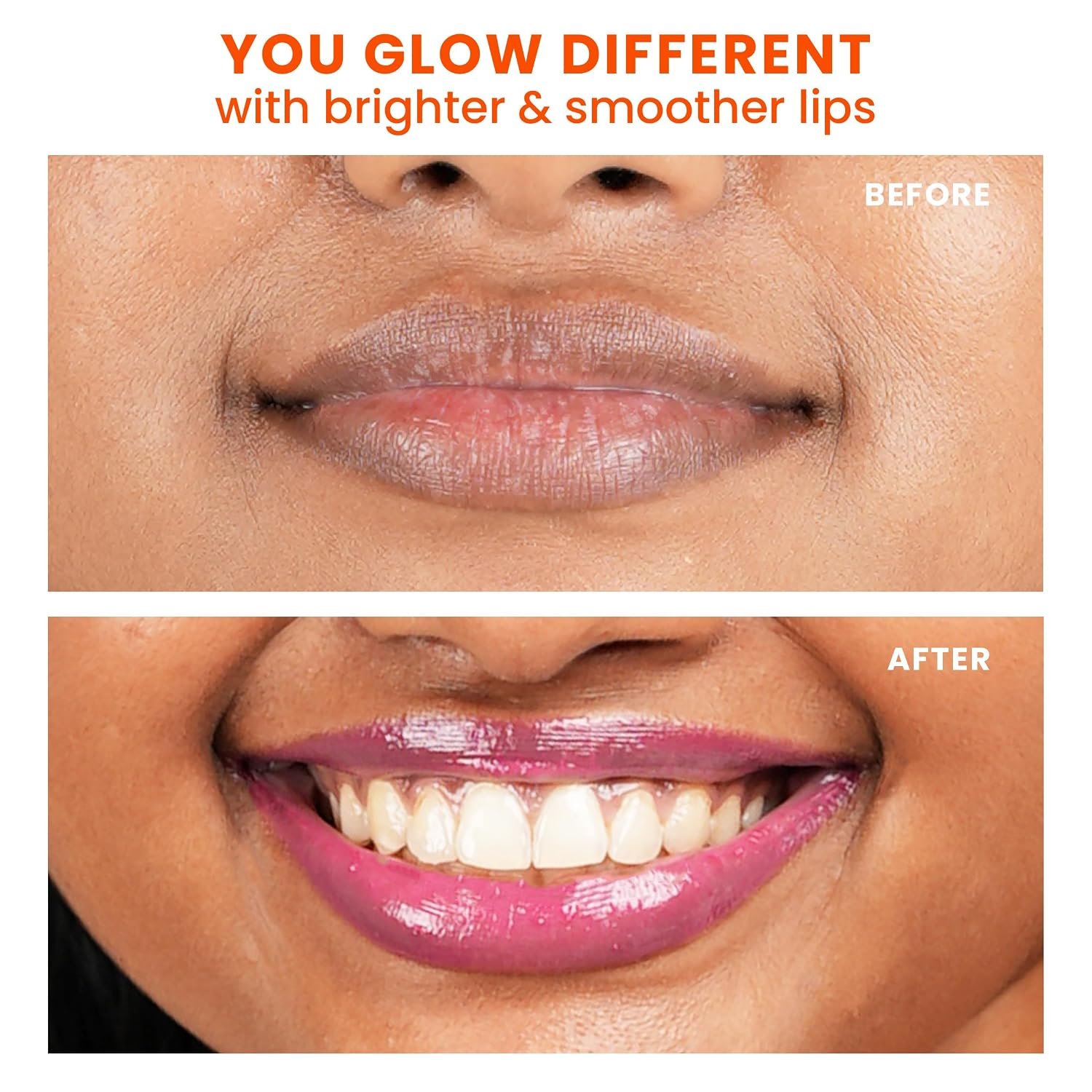 Foxtale SPF 30 Brightening Lip Balm for Dark Lips with Peptides & Vitamin C | Brightens | Hydrates | Tinted Lip Balm - Pink Glaze 12gm thumbnail