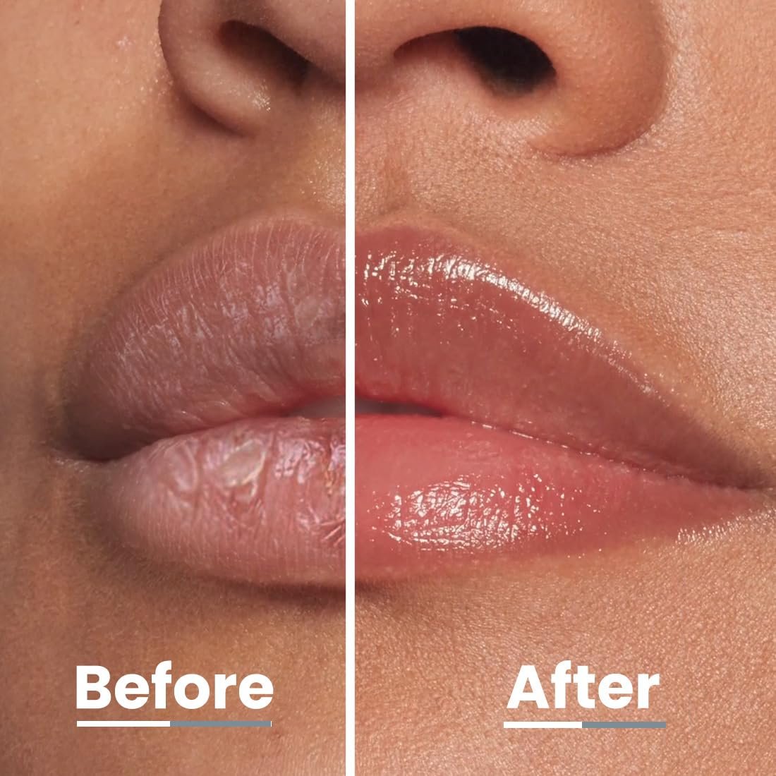 Hyphen-Vitamin Infused Peptide Lip Balm-Vanilla for Dry & Chapped Lips|Hydrating & Moisturizing Lip Balm for Unisex|for Dark Lips| Vegan,SLS & Parabens Free|10gm thumbnail