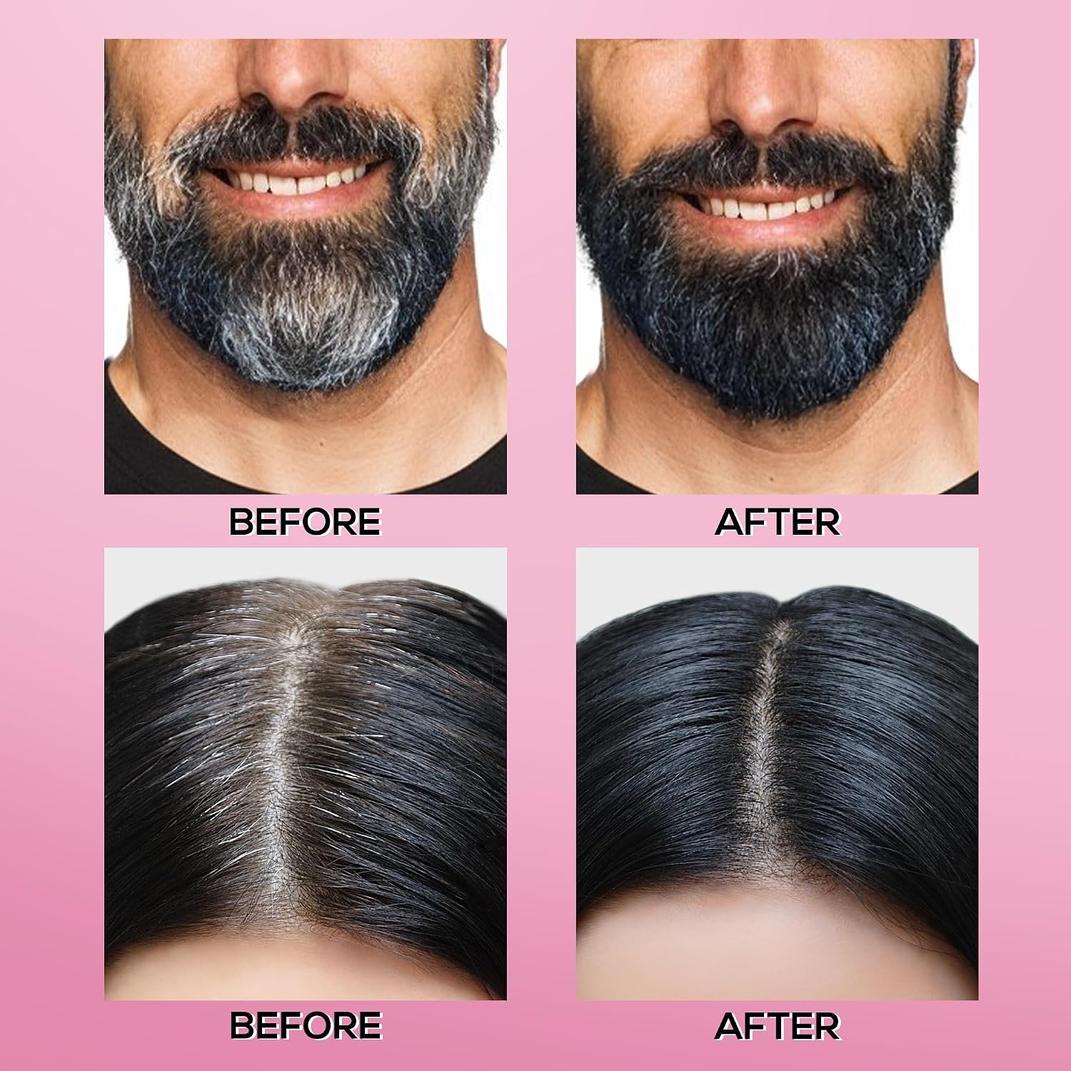 RENEE Cover-Up Hair Powder - Black | Covers Grey Roots & Bald Spots Instantly | Highly Pigmented, Fuller & Denser Look | Long-Lasting | Matte Finish | Fine Powder | Flawless Application 4gm thumbnail