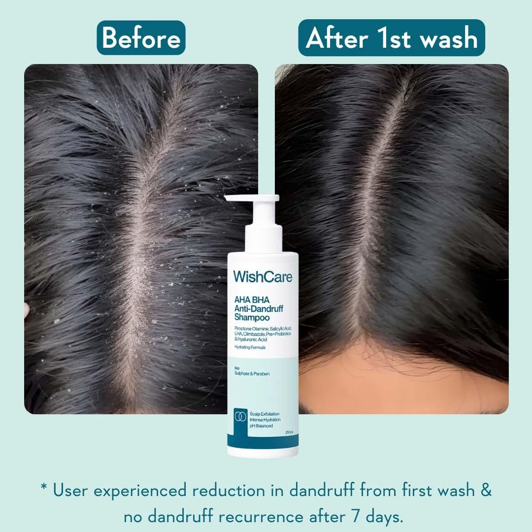 WishCare Hydrating Anti Dandruff Shampoo | 100% Dandruff Reduction | Removes Flakes & Hydrates Scalp | Proven Clinically |  For Women And Men | 250ml thumbnail