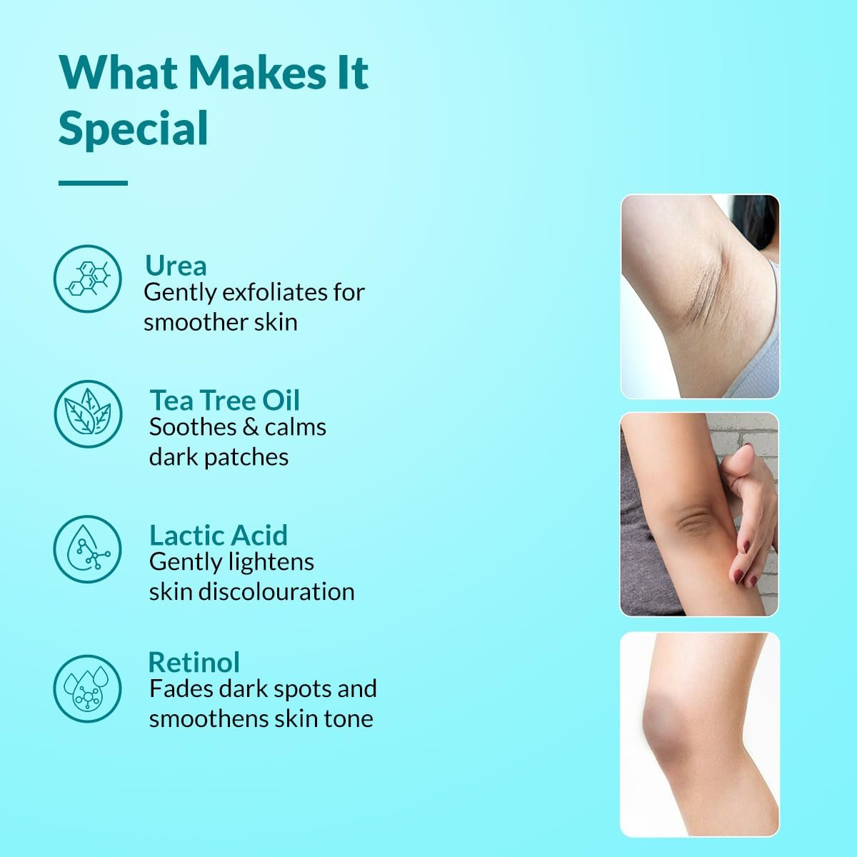 Fixderma Nigrifix Cream for Acanthosis Nigricans with Lactic Acid | Dermatologist Tested Retinol Cream | For Dark Body Parts like Neck, Ankles, Thighs & Elbows | Exfoliant- 50g thumbnail