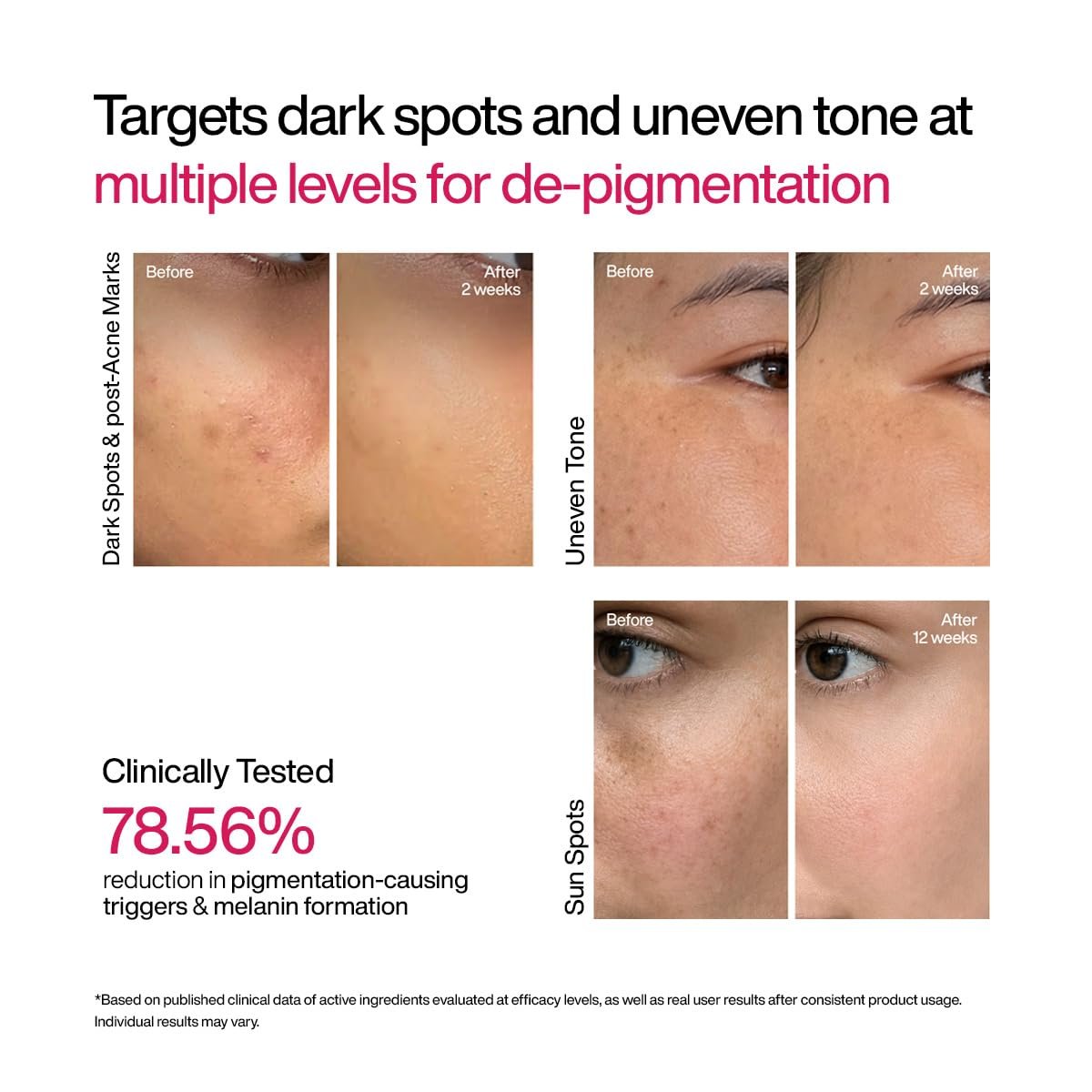 WishCare Advanced Dark Spot Correcting Serum - Niacinamide TXA Shot | 10% Niacinamide Face Serum For Pigmentation and Dark Spot | With 2% Alpha Arbutin & TXA for Glowing Skin | 10ml thumbnail