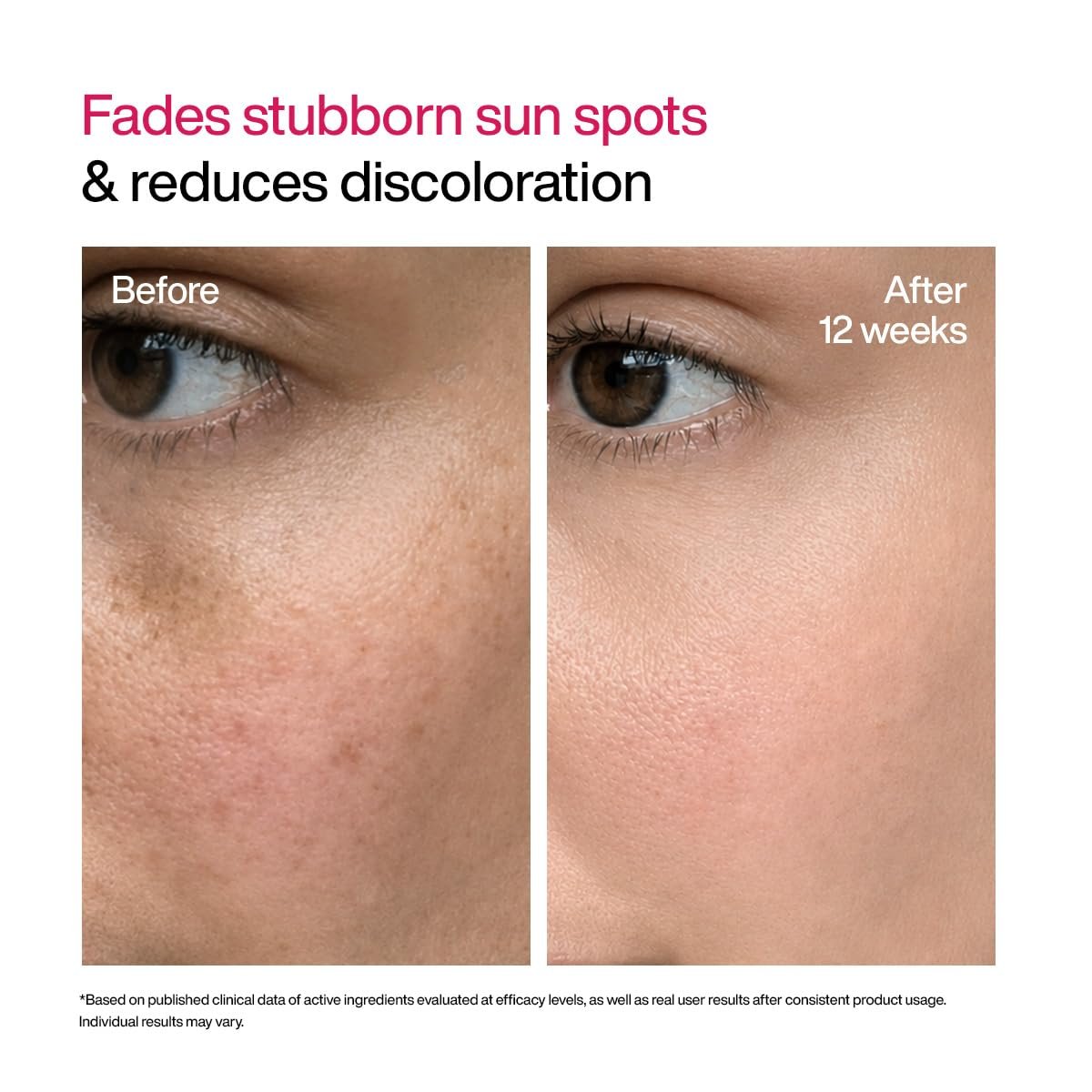 WishCare Advanced Dark Spot Correcting Serum - Niacinamide TXA Shot | 10% Niacinamide Face Serum For Pigmentation and Dark Spot | With 2% Alpha Arbutin & TXA for Glowing Skin | 10ml thumbnail