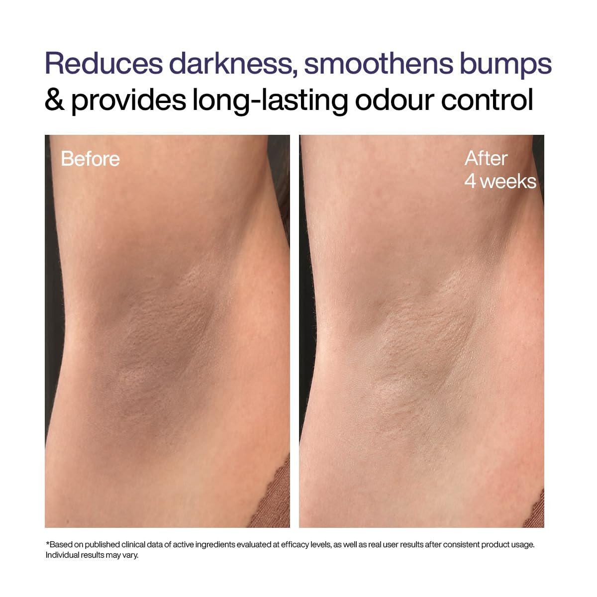 WishCare Underarm Roll On For Women With 5% AHA, 3% Kojic Acid, BHA, Licorice, Inulin - Underarm Lightening & Odour Control - Long Lasting Floral Fragrance thumbnail