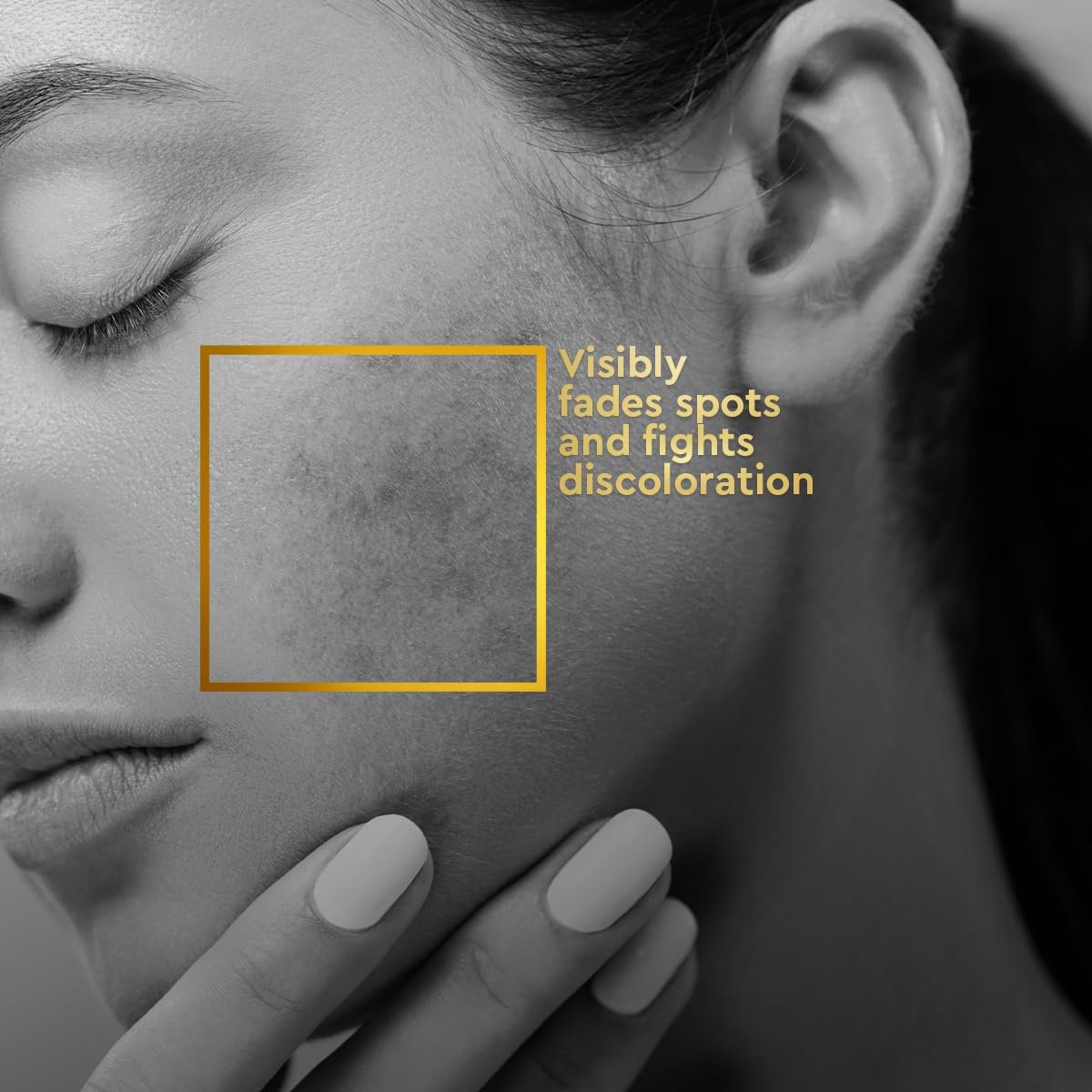 VLCC Clinic ProPerfect Spot Clarifying Face Wash 150 ml - AlphaXTM Complex is known for Spot lightening | Powered by Alpha Arbutin and Niacinamide thumbnail