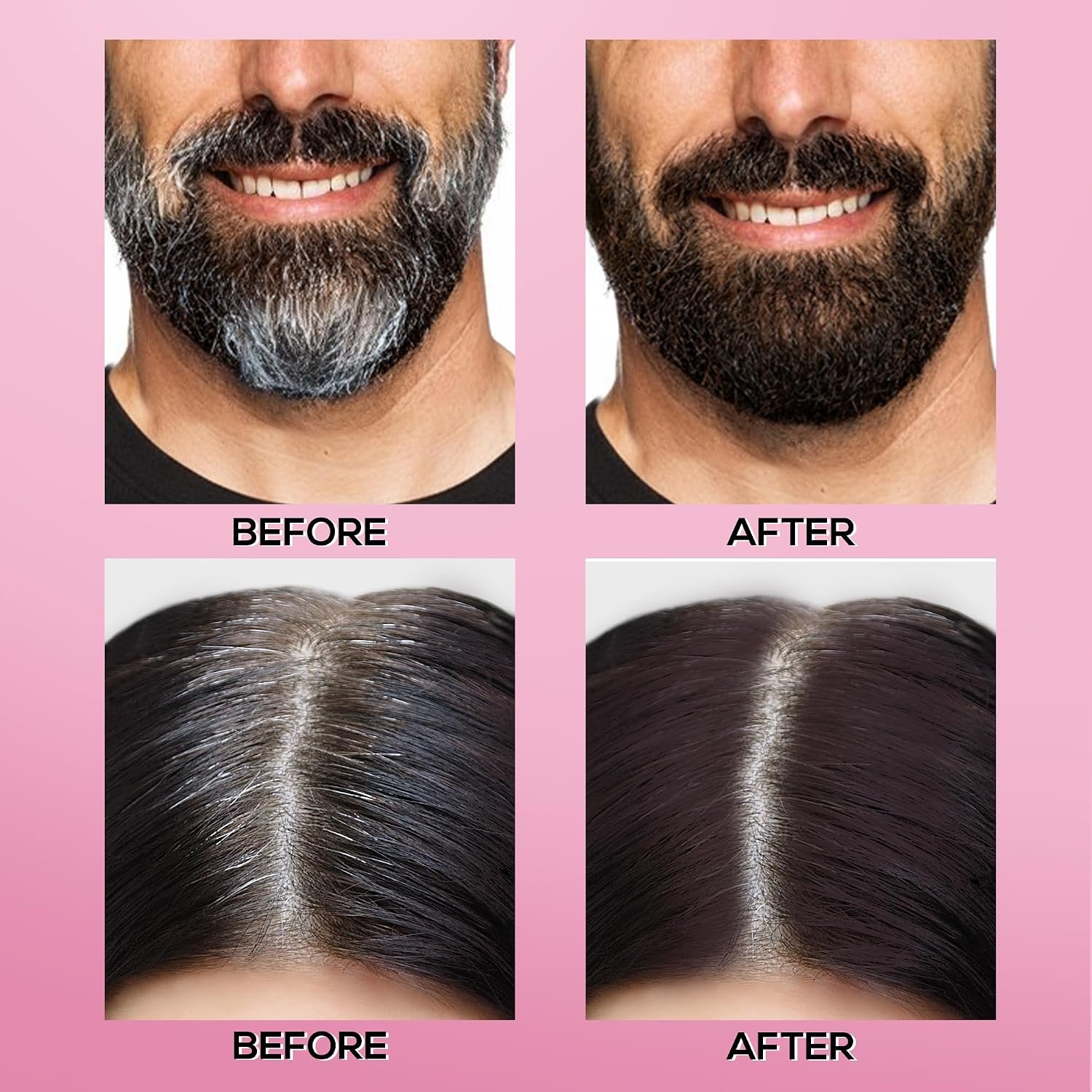 RENEE Cover-Up Hair Powder - Brown | Covers Grey Roots & Bald Spots Instantly | Highly Pigmented, Fuller & Denser Look | Long-Lasting | Matte Finish | Fine Powder | Flawless Application 4gm thumbnail