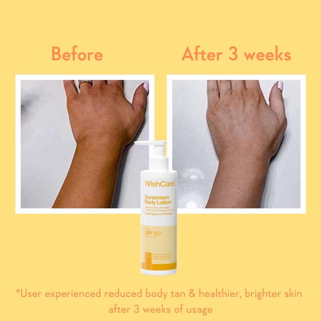 WishCare Sunscreen Body Lotion with SPF 50 PA++++ In- Vivo Tested | Body Sunscreen SPF50 With Broad Spectrum UVA & UVB Protection, No White Cast |   For Women & Men | 200ml thumbnail