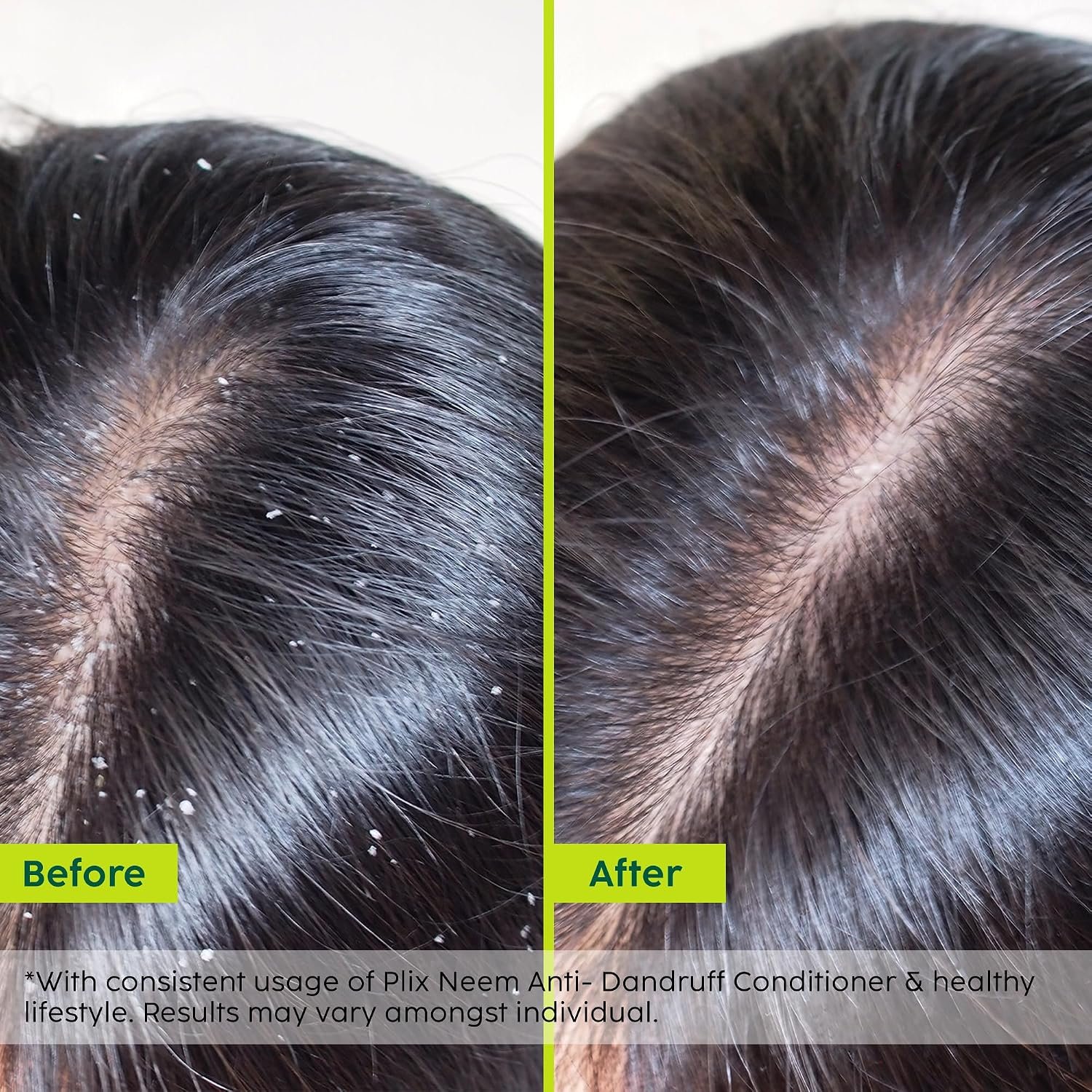 PLIX - THE PLANT FIX Neem Anti-Dandruff Advanced Conditioner | Reduces Dandruff, Dryness & Frizz | With Dandelix Pro™ & Murumuru Butter | Locks in Moisture | Paraben & Sulphate Free | 100 ml thumbnail