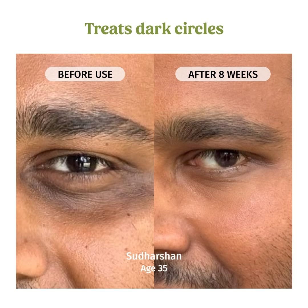 Vilvah Under Eye Cream | Reduces Dark Circles, Puffiness & Eye Bags | Hydrates, Smoothens Fine Lines & Firms Skin | Lightweight Eye Care for Tired Eyes | 20ml thumbnail