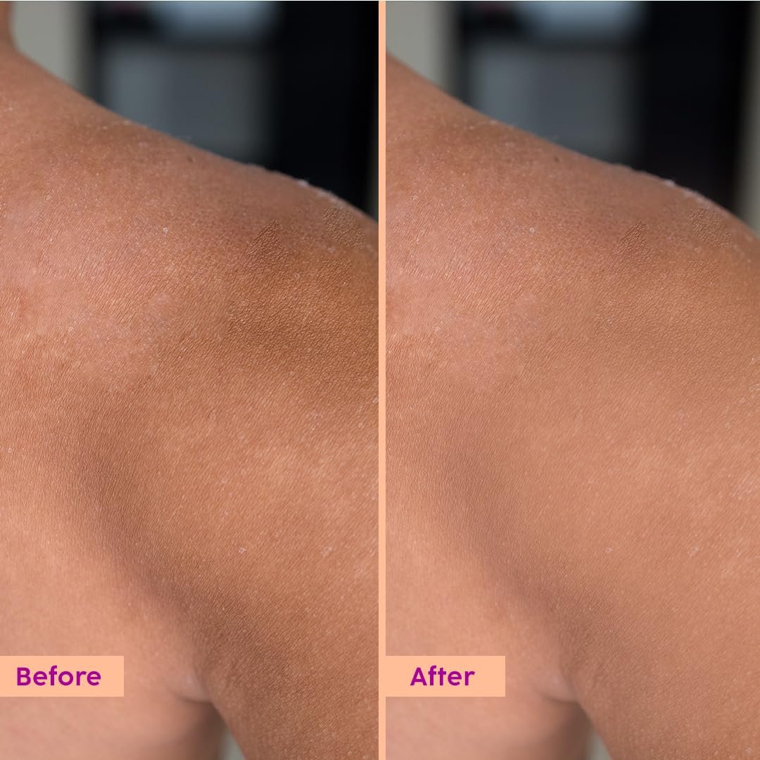 PLIX THE PLANT FIX Peaches & Lemon D-Tan Body Lotion With New-Age UV Filters | In Vivo Tested SPF 30 PA+++ | Lightweight & Non-greasy | Helps Brighten & Moisturize thumbnail