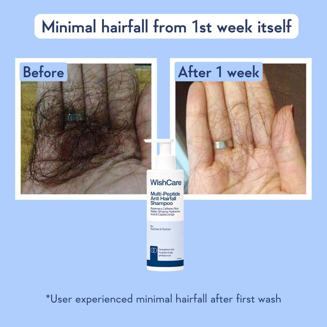 WishCare Multi Peptide Anti Hairfall Shampoo For Frizzy and Dry Hair | Controls Hairfall & Promotes Hair Growth | Peptides, Rice Water, Rosemary & Caffeine | or All Hair Types | 250ml thumbnail