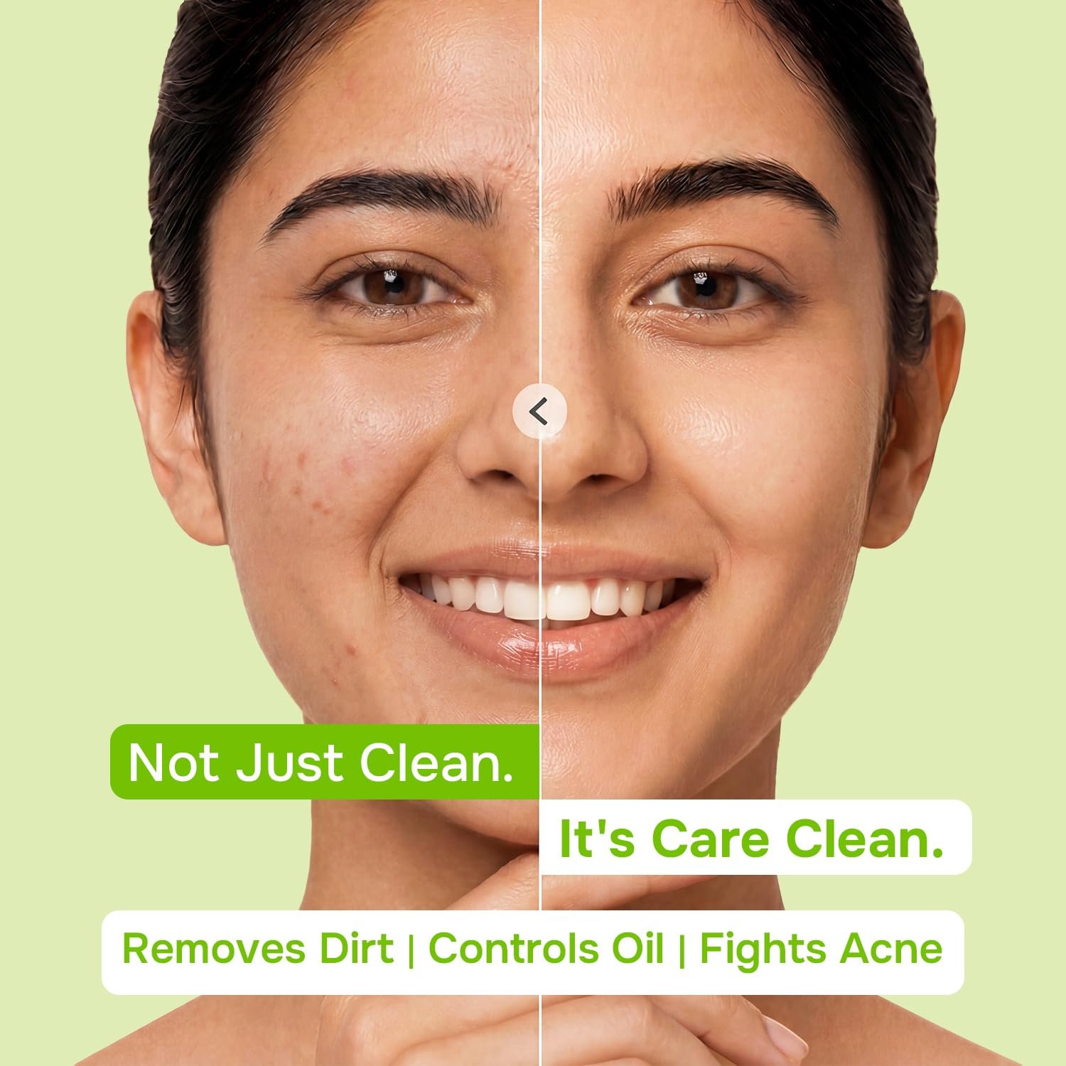 Swiss Beauty Care Juicy Glow Face Wash | Tea Tree + Salicylic Acid 1% | Removes Dirt & Grime | Combats Acne | Reduces Excess Oil | Unclogs Pores -100g thumbnail