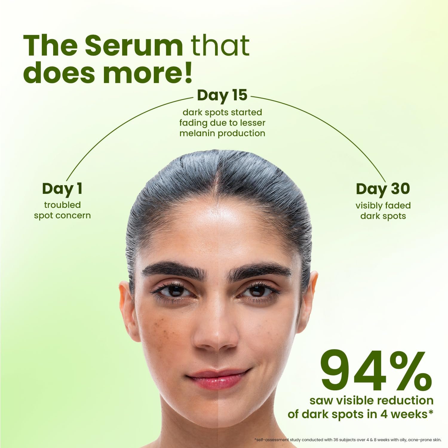 Dot & Key 10% Niacinamide + Cica Serum | Reduces Acne & Dark Spots | Niacinamide Serum | Alpha Arbutin | Controls Excess Oil, Quick Absorbing, & Lightweight 20ml thumbnail