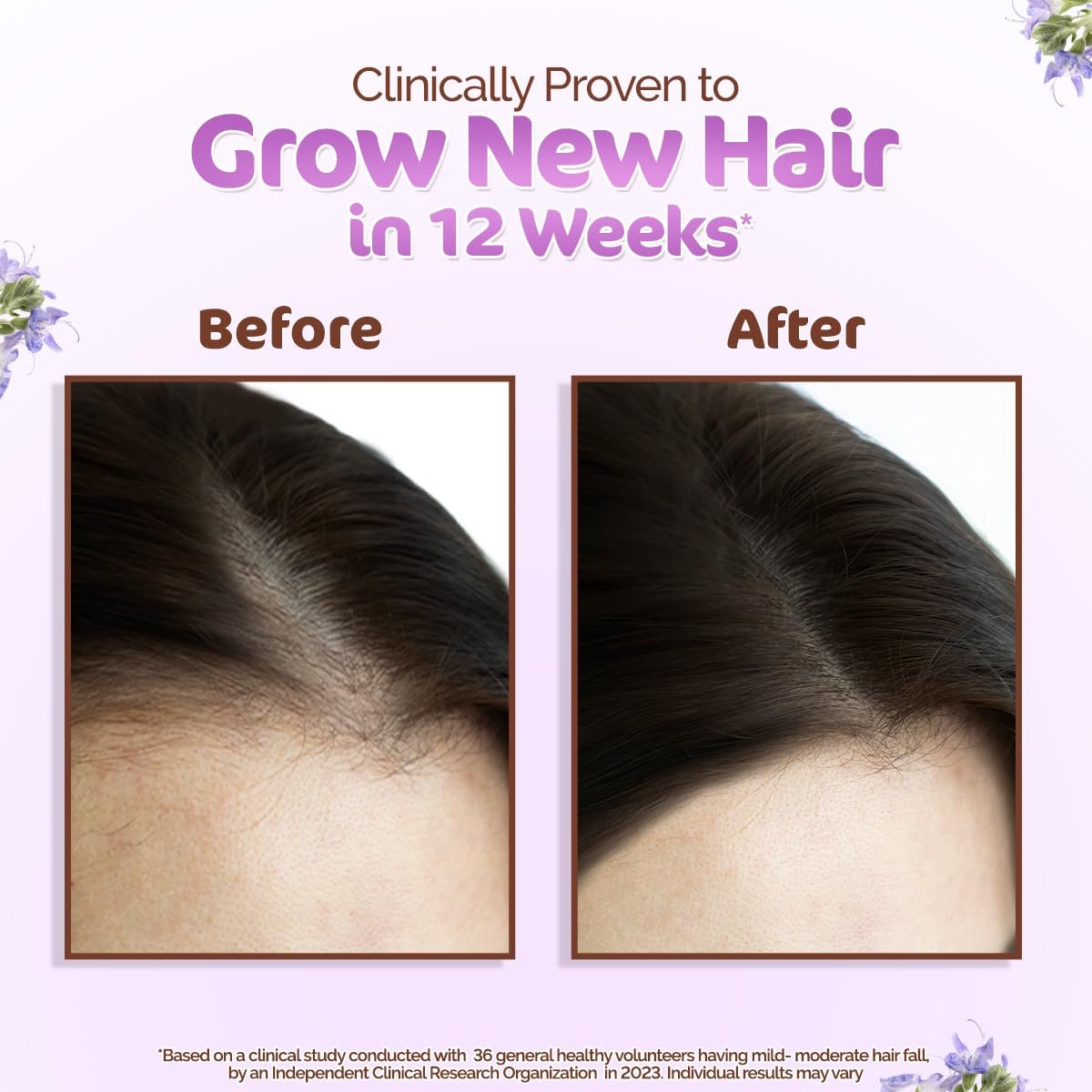Mamaearth Rosemary Hair Growth Oil with Rosemary & Methi Dana for Promoting Hair Growth - 150 ml thumbnail