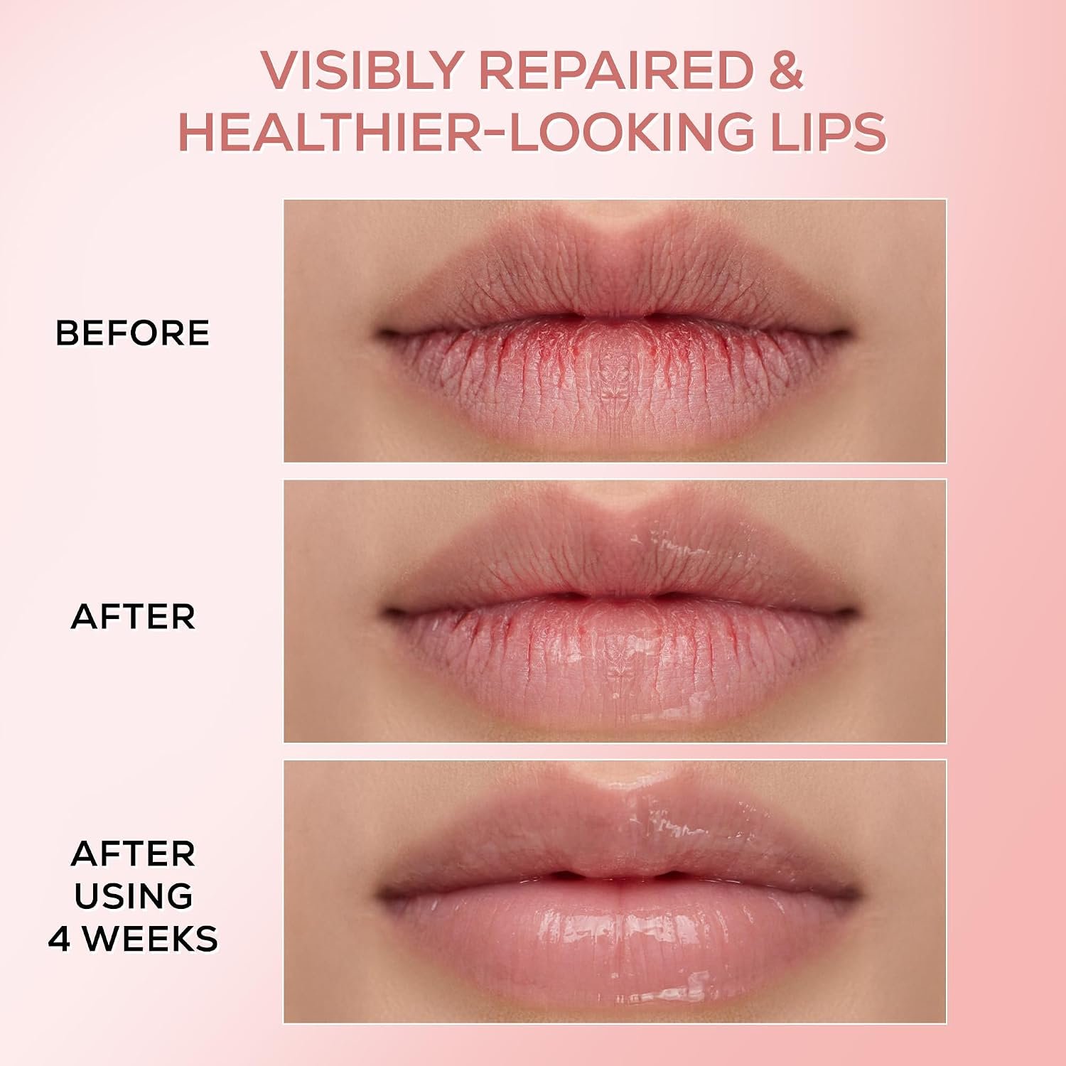 RENEE Pink Therapy PDRN Overnight Lip Repairing & Moisturising Lip Balm For Dry, Chapped Lips | Glossy Finish, Revives Lip Barrier & Improves Elasticity | 10g thumbnail