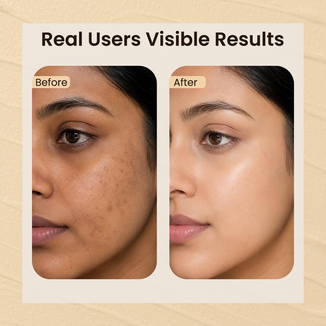 Jovees Herbal Glow Face Pack for Tan Removal & Brightening | Clay Face Mask to Clean Pores, Remove Blackheads & Dark Spots | Hydrating Face Pack for All Skin Types - 120g thumbnail