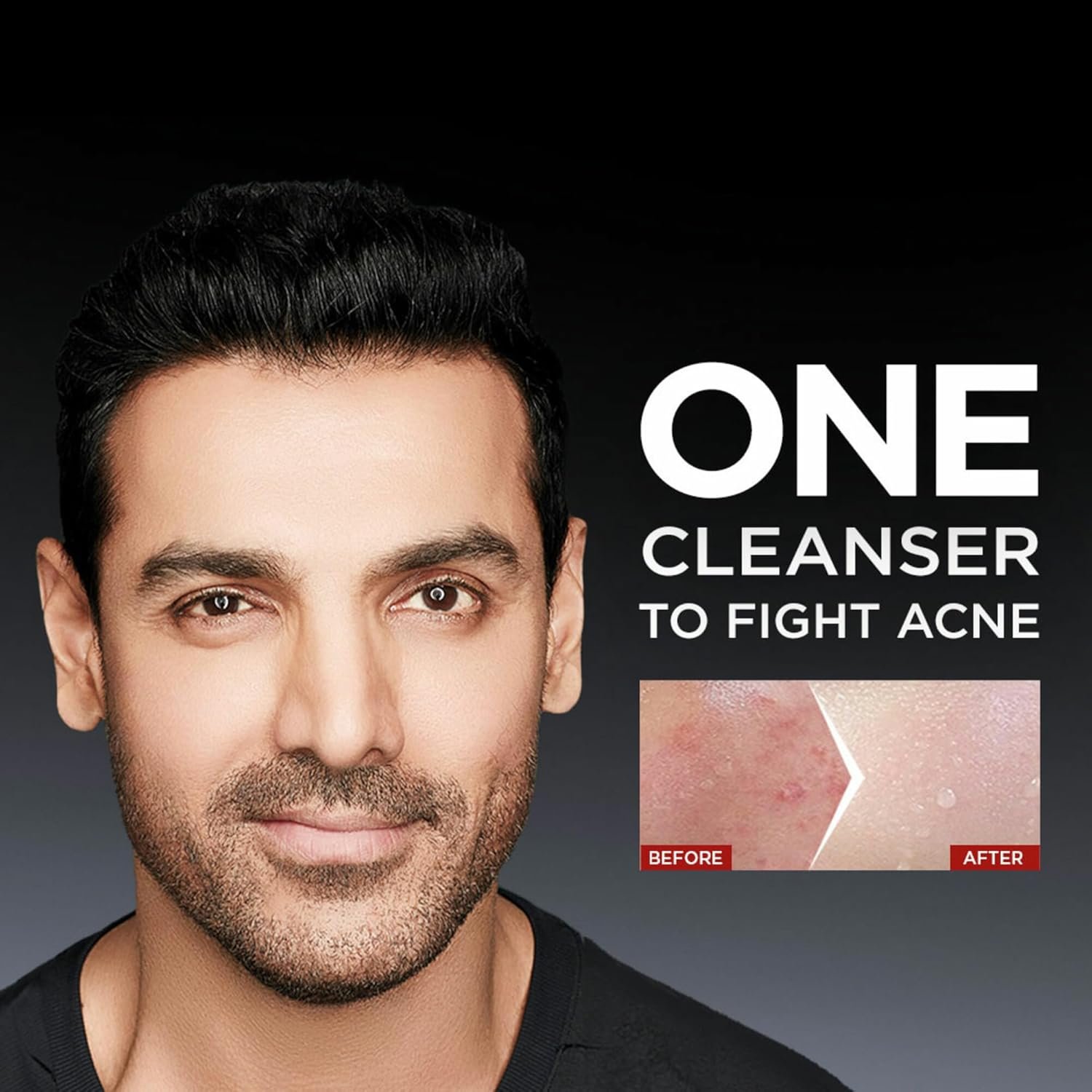 Garnier Men, Anti-Pimple Face Wash, Repairs Skin & Balances Oils, AcnoFight, 100 g thumbnail