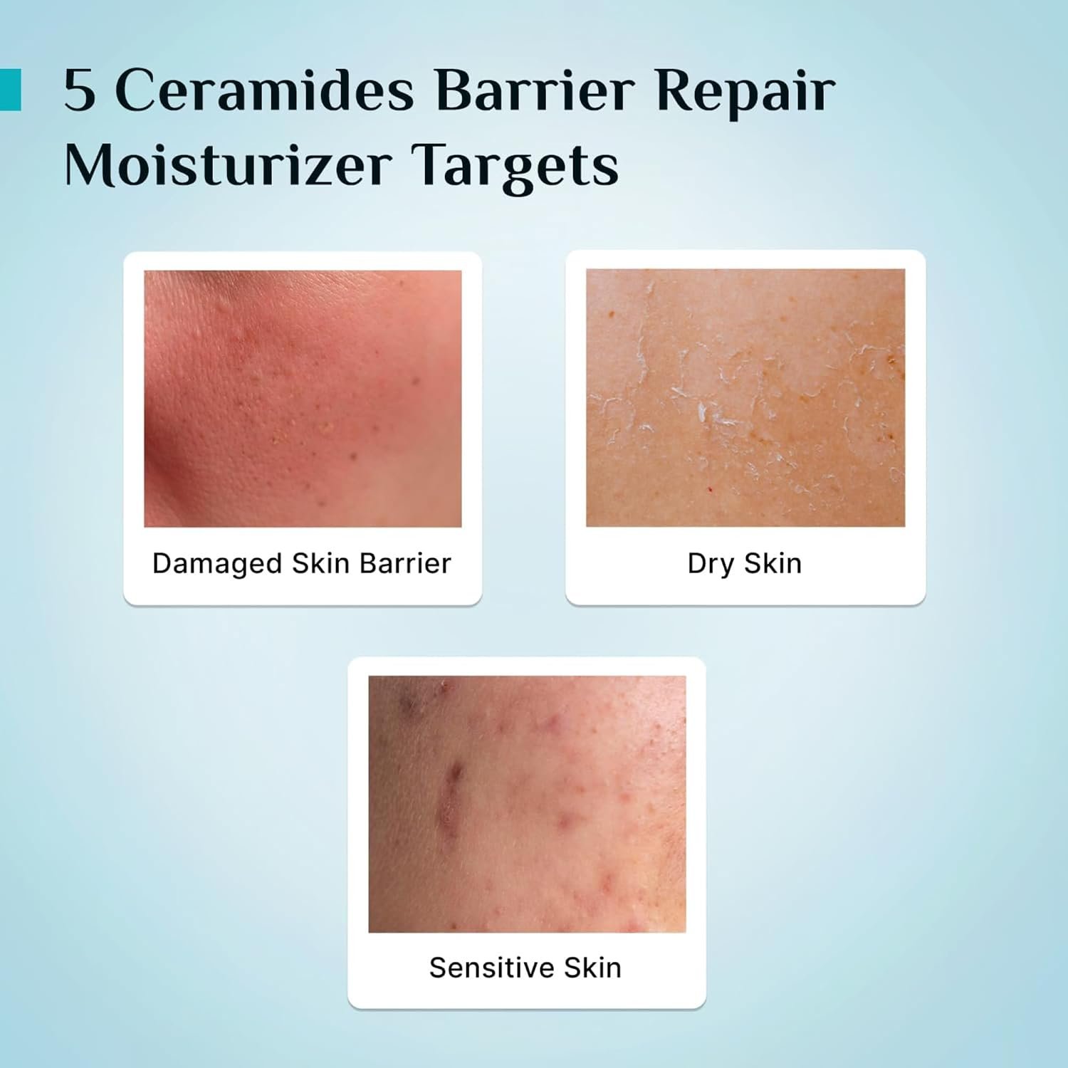 Pilgrim 5 Ceramides Moisturizer for Face 100g | Hyaluronic Acid for Intense Moisturizing & Skin Strengthening | Barrier Repair with Korean CICA | Lightweight & Non-Sticky | For All Skin Type thumbnail