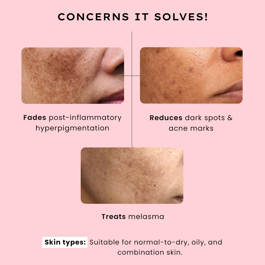 Hyphen 4% Tranexamic Acid + 5% Niacinamide Biphasic De-Pigmentation Serum | Correction & Prevents Hyperpigmentation, Dark Spots & Melasma| Deep Penetration - 30 ml thumbnail