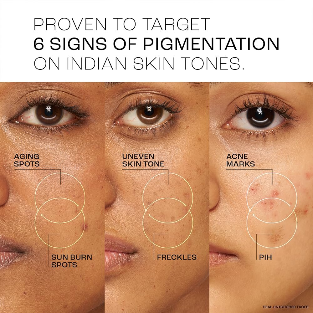 Lakme Perfect Radiance Pigmentation Treatment Day Gel Crème 50g thumbnail
