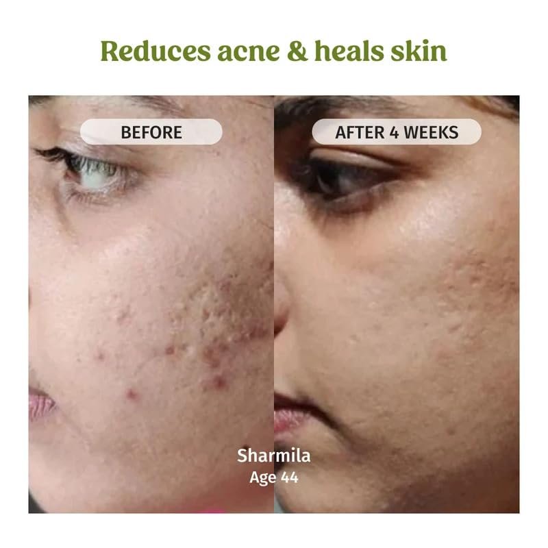 Vilvah Aloe Vera Gel for Face, Skin & Hair | Soothing & Hydrating Gel | Helps Reduce Acne, Calm Irritation & Add Shine to Hair | Lightweight, Hydrating & Non-Sticky Formula | 100ml thumbnail