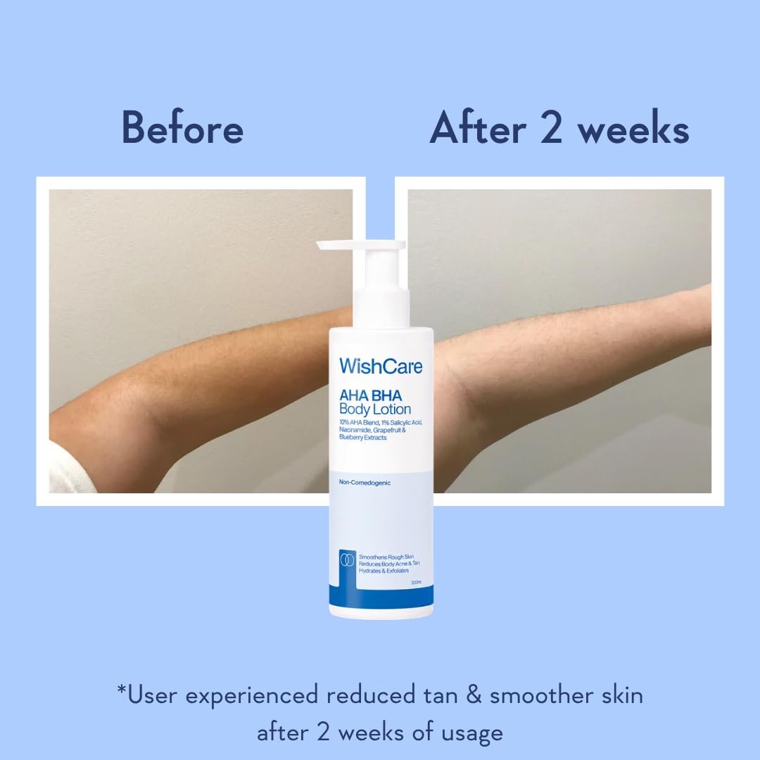WishCare AHA BHA Body Lotion For Dry Skin | Provides Deep Hydration, Detans & Smooths Rough Skin | With 10% AHA & 1% BHA | Daily Use Body Lotion For Women & Men | 200ml thumbnail