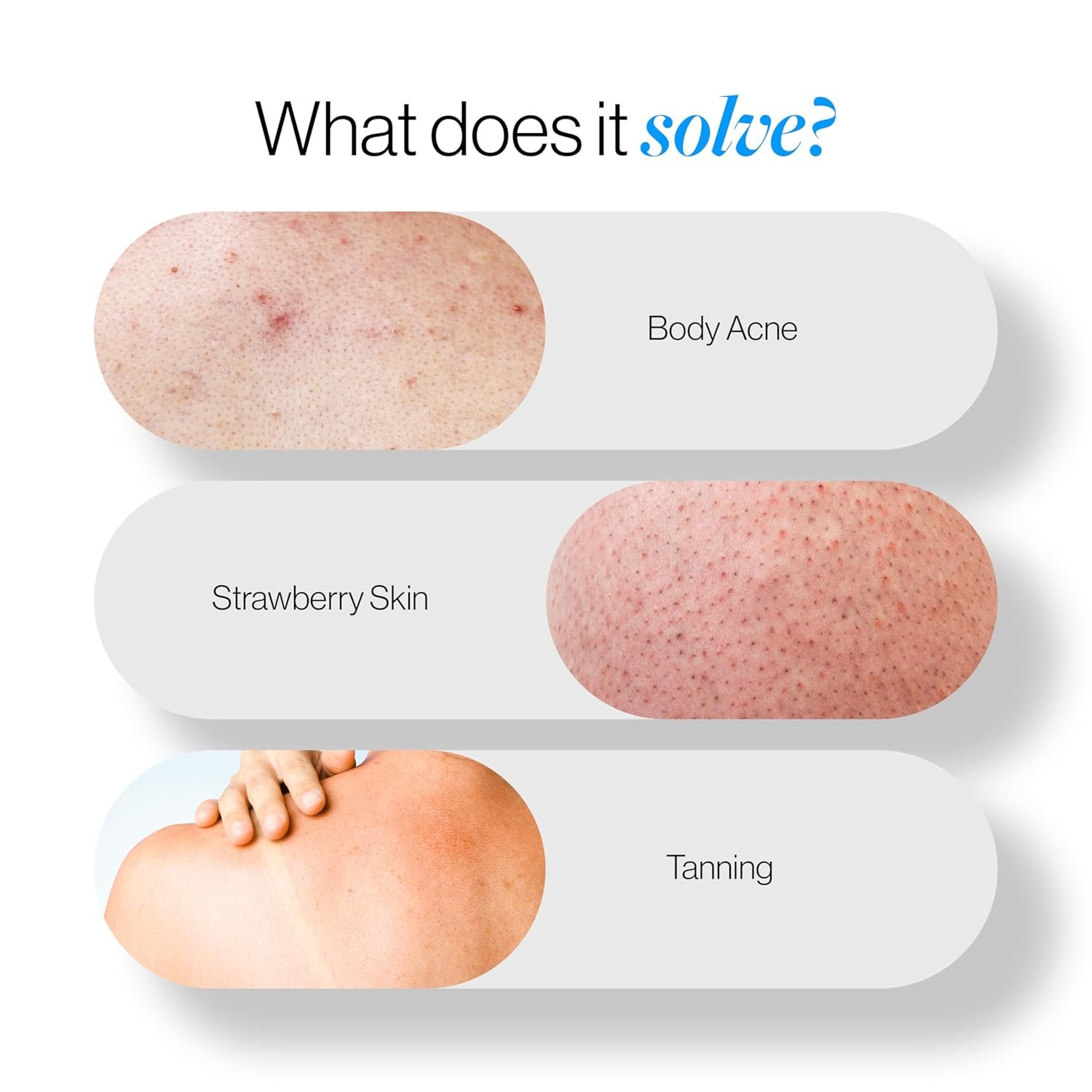 Be Bodywise 12% De-Tan AHA Body Scrub | Exfoliating Scrub with Glycolic Acid & Lactic Acid | Smoothens Strawberry Skin & Rough Bumps | Oat & Aloe Extract for Hydration |  300g thumbnail