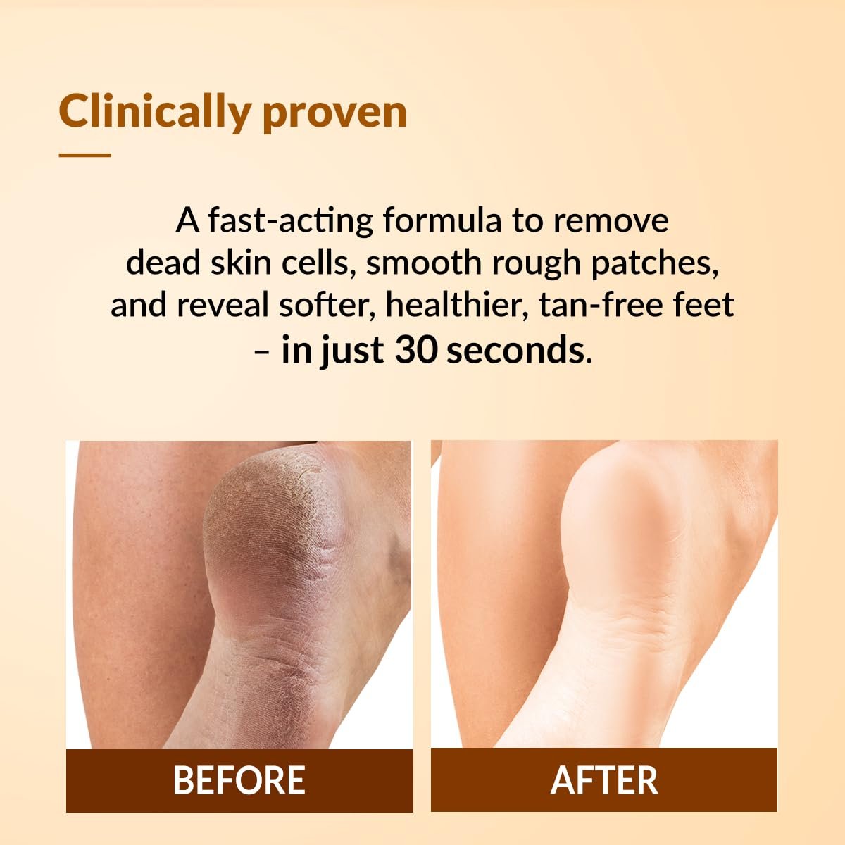 Fixderma Foobetik Foot Scrub Spray with Lactic Acid | 30 sec Foot Facial Spray | Foot Scrubber for Dead Skin | Callus Remover Spray | Heel Scrubber for Feet|Instantly Smooth & Soft Feet 50ml thumbnail