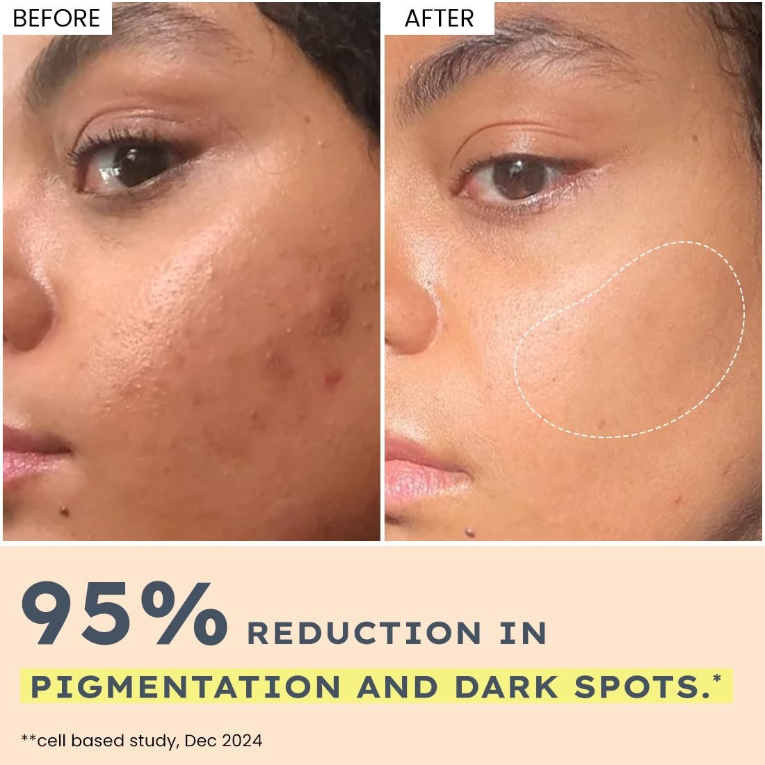 Hyphen 44% Rice Water Brightening Face Serum Pads | 5% Niacinamide & Alpha Arbutin to Reduces Dark Spots & Pigmentation | Toner Pads with Serum for Glowing Glass Skin | All Skin Types - 50N thumbnail