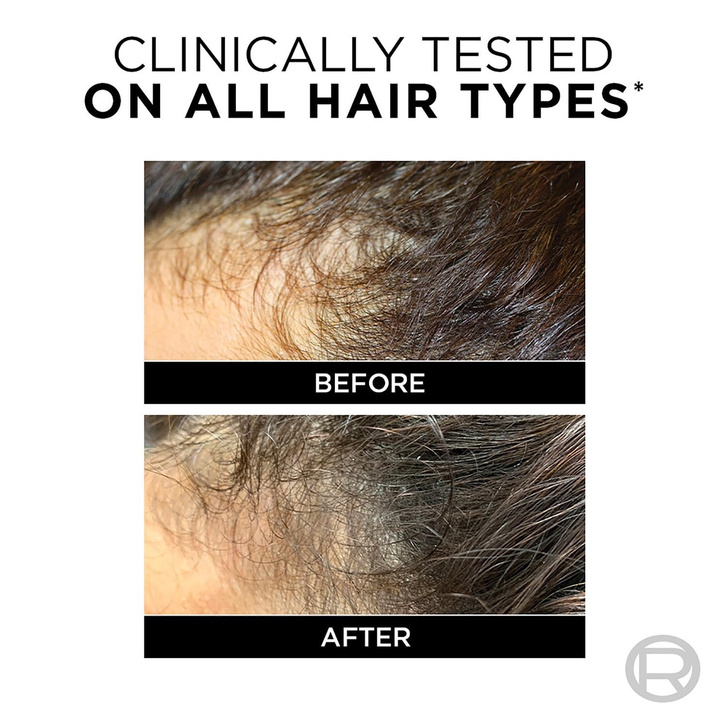LOreal Paris Fall Resist 3X Anti-Hairfall Shampoo with Arginine Essence For Weak Hair with Tendency to Fall and Hair Thinning, Reduces Hair Breakage and Nourishes Roots- 650ml thumbnail